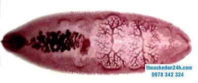 BỆNH SÁN LÁ GAN: NGUYÊN NHÂN, TRIỆU CHỨNG, CÁCH PHÒNG NGỪA