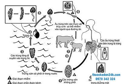 BỆNH SÁN LÁ GAN: NGUYÊN NHÂN, TRIỆU CHỨNG, CÁCH PHÒNG NGỪA