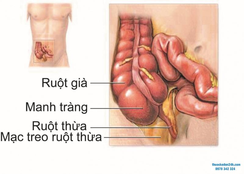 Viêm ruột thừa diễn biến thế nào và kéo dài bao lâu?