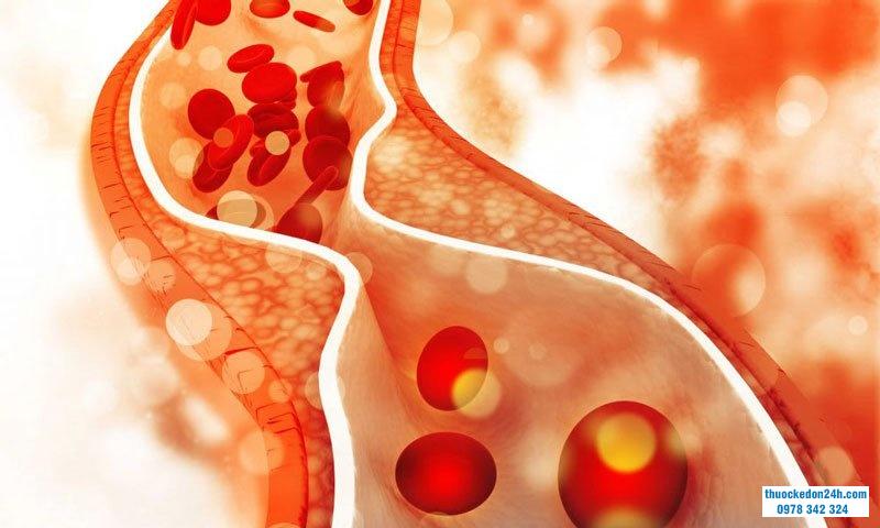 Điều trị dứt điểm mỡ máu kèm rối loạn lipid máu?