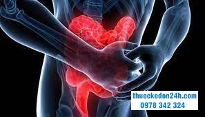 Xuất huyết tiêu hóa