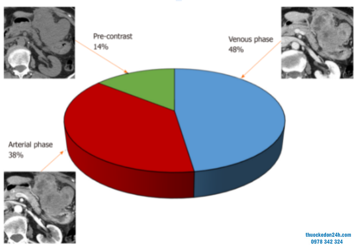 ung-dung-ky-thuat-tao-hinh-du-lieu-hoa-trong-u-mo-dem-duong-tieu-hoa-1