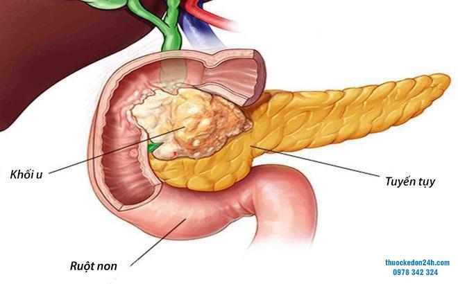 rối loạn tuyến tụy